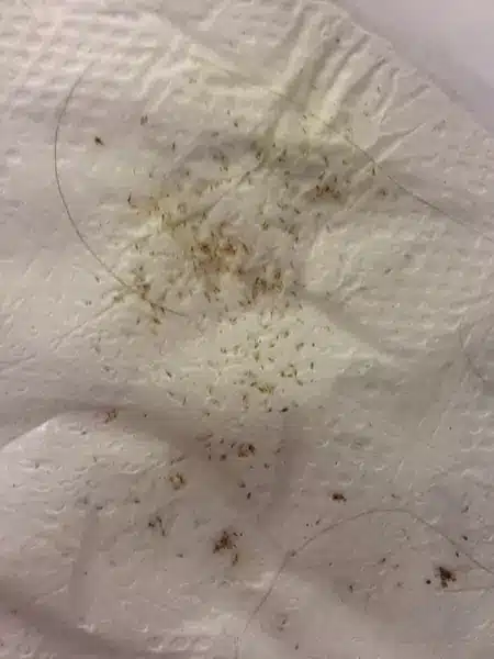 Nits On Paper Towel Are Indicative Of Poor Quality